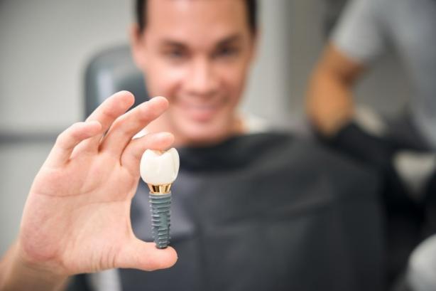 pose implant dentaire