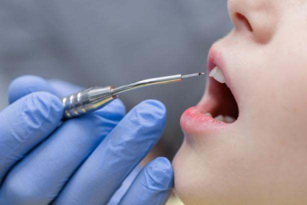 soins dentaires enfants soins dentaires enfants