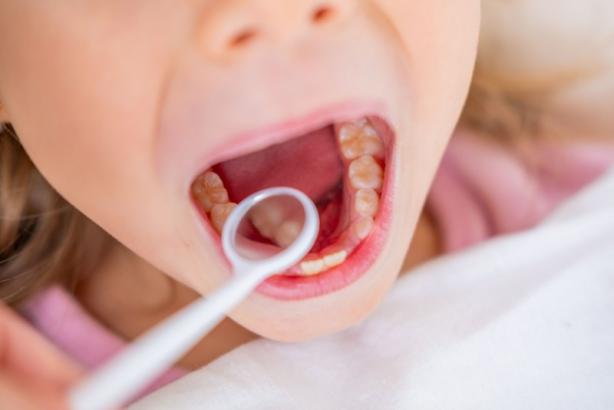 dentiste enfant dentiste enfant